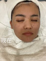 -郡艺医疗美容·微整·眼鼻吸脂