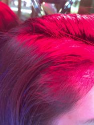 -碧莲盛·不剃发植发