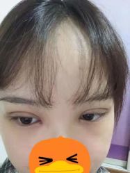 -成都西区医院整形美容