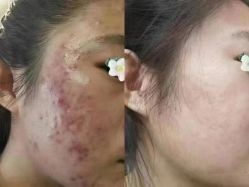 -康美贞·痘肌养护管理中心