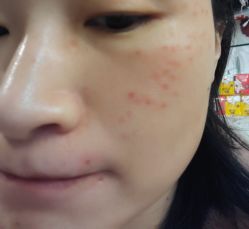 -针美汇欧邦医疗美容