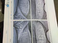 -武汉大学附属爱尔眼科医院(湖北总院)