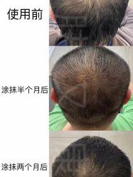 -天其美科学美肤·生发健康管理