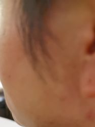 -美瑞莎创美医疗美容