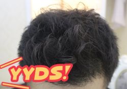 -大麦微针植发丨全国连锁