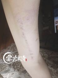 -雲艺刺青·洗纹身