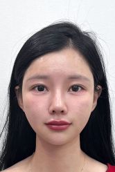 -广州曙光医学美容医院