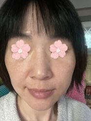 体验前-北京炫美医疗美容