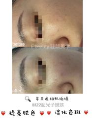 -E.beauty驻颜·痘敏肌调理中心