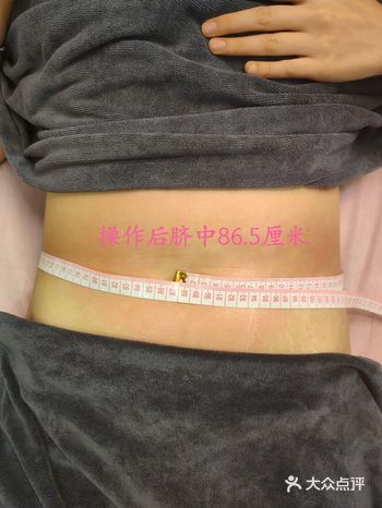 塑型减重同时完成的魅力