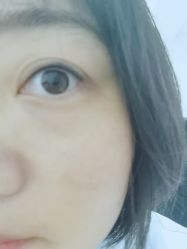 体验后-北京英煌医疗美容