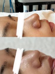点击看大图 -AURAS璈然科技护肤中心