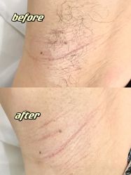 -植蔻妍倍儿专业脱毛·皮肤管理