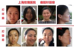 -上海玫瑰医疗美容医院