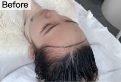 -西施无菌半永久纹绣眉眼影唇轻增发纹发际线