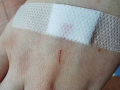 -浙江省立同德医院(翠苑院区)