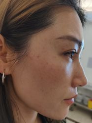 -长沙雅美医疗美容医院