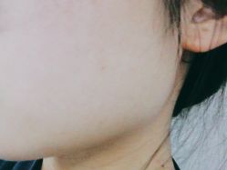 体验后-广州美莱医疗美容医院