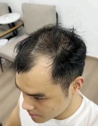 -唐风采假发补发定制