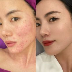 -艾尚妮·美容美体SPA