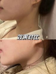 -天津时光诺颜·轻医美·轮廓抗衰中心