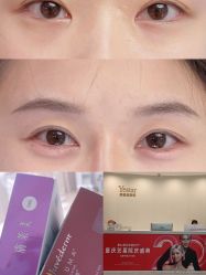 -Yestar重庆艺星医疗美容医院