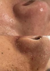 -SKIN79皮肤管理中心