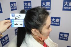 -大麦微针植发丨全国连锁