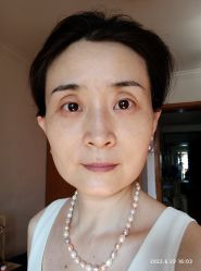 体验后-紫洁俪方（北京）医疗美容