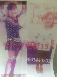 -寇氏拔罐减肥