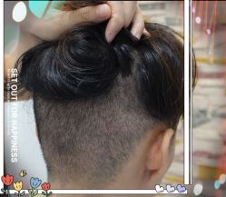 -大麦微针植发全国连锁