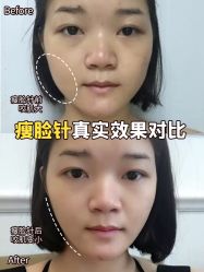 -重庆军科整形美容医院