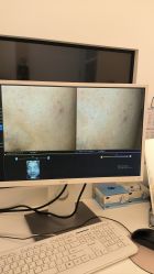 -苑苑vbeauty科技美容SPA