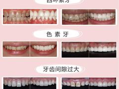 -团圆口腔·种植中心(锦江院区)