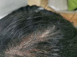 点击看大图 -熙朵美学植发连锁