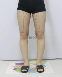 体验前-禾美嘉医疗美容