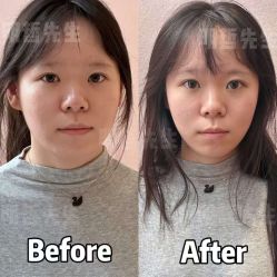 -颜和骨正&明星徒手小颜整骨