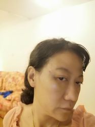 -天津健丽·去眼袋医疗美容机构