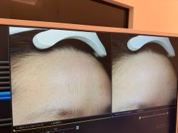 -苑苑vbeauty科技美容SPA