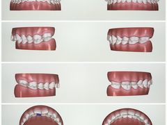 -爱雅仕口腔·数字化矫正中心(国贸门诊)