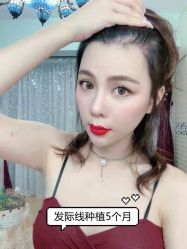 -大麦微针植发全国连锁