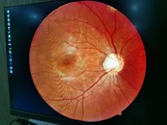 -宝岛眼镜(杭州万塘路旗舰店)