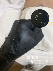-康美贞·痘肌养护管理中心
