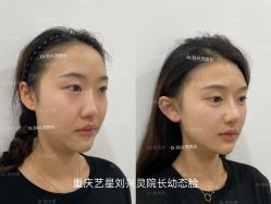 -Yestar重庆艺星医疗美容医院