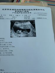 -北京市东城区妇幼保健院(北院区)