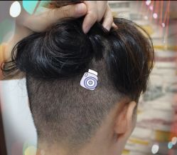 -大麦微针植发全国连锁