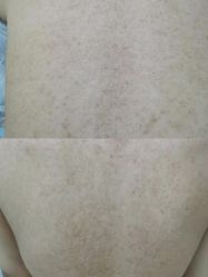 -中科妍美专业脱毛美肤连锁机构