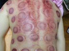 -沈师傅盲人按摩工作室(密三小区店)