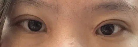 -广州美莱医疗美容医院