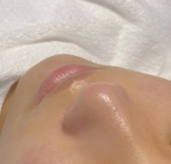 -Younger Skin·科技氧肤中心